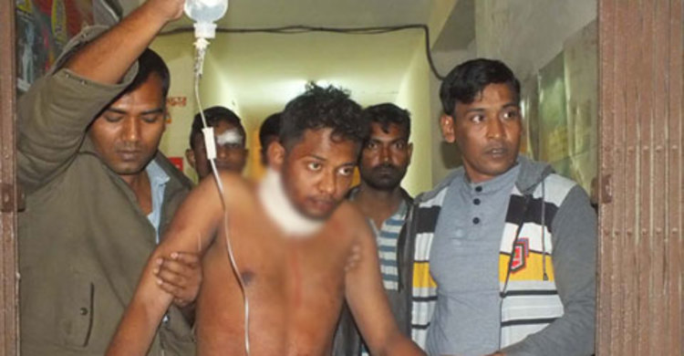 মোটরসাইকেলের জন্য গলাকেটে হত্যার চেষ্টা