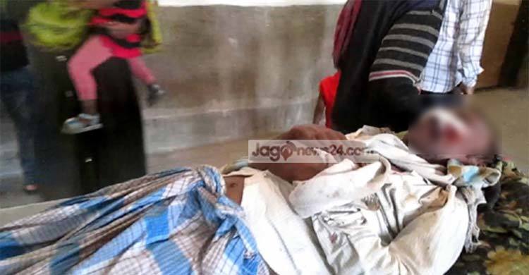 লক্ষ্মীপুরে ইটভাটা শ্রমিককে কুপিয়ে জখম