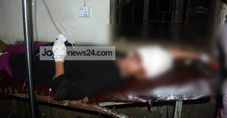 Sylhet college girl on life-support at Squar Hospital