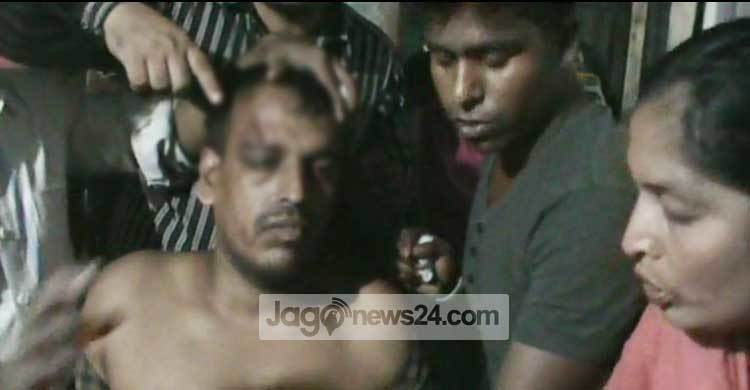 মাদারীপুরে দুই ইউনিয়নবাসীর সংঘর্ষে আহত অর্ধশতাধিক