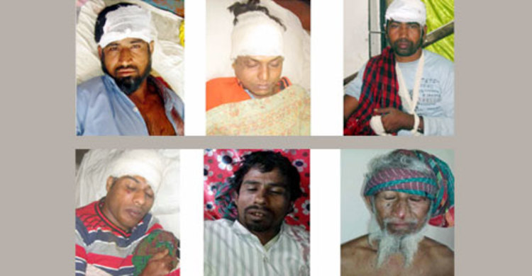 মাগুরায় পৃথক সংঘর্ষে আহত ৩০