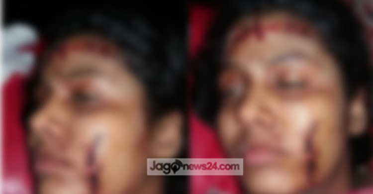 প্রেমে রাজি না হওয়ায় মাদরাসাছাত্রীকে কুপিয়ে জখম