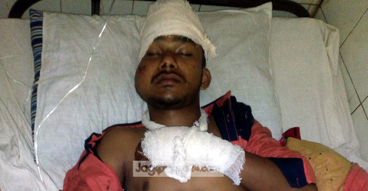 পটুয়াখালীতে এইচএসসি পরীক্ষার্থীকে কুপিয়ে জখম