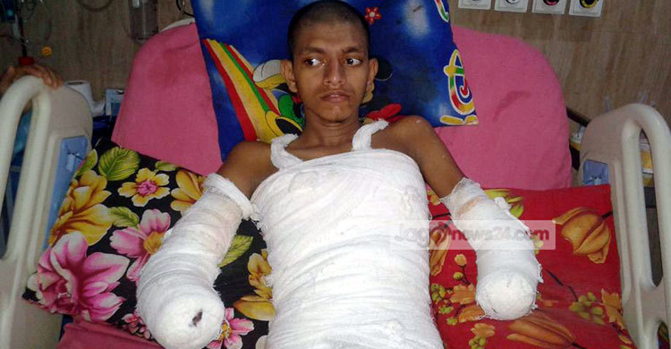 পল্লী বিদ্যুতের অবহেলায় হাত কাটা পড়ল মেধাবী ছাত্রের