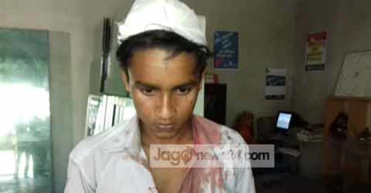 শিক্ষার্থীর মাথা ফাটালেন দু্ই শিক্ষক