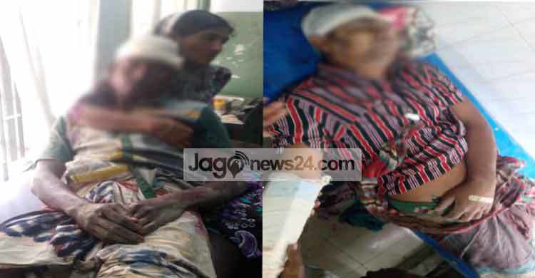 তাড়াশে খাস জমি দখল নিয়ে সংঘর্ষে আহত ১৫