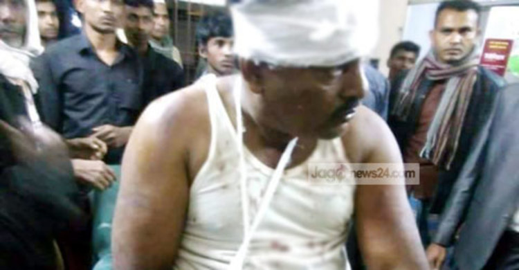 রামুতে ইউপি সদস্যকে কুপিয়ে জখম