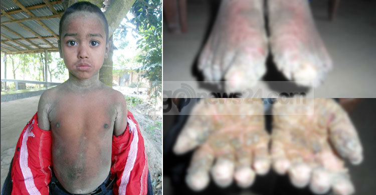 অজানা রোগে আক্রান্ত মেহেদী হাসান