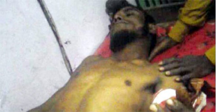 ভাল্লুকের সঙ্গে যুদ্ধ করে আহত হয়ে ফিরলেন কাঠুরিয়া