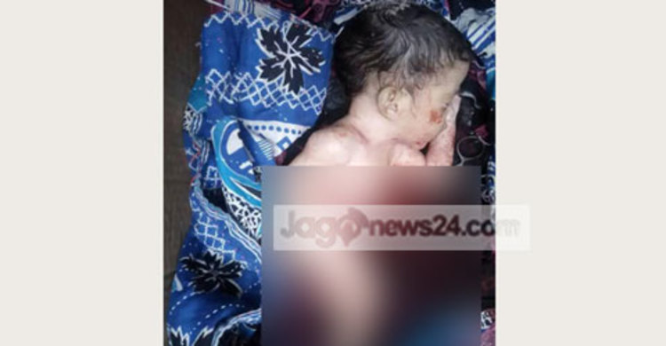 সিজারে নবজাতকের নাড়ি-ভুঁড়ি ও কলিজা বের হওয়ার অভিযোগ