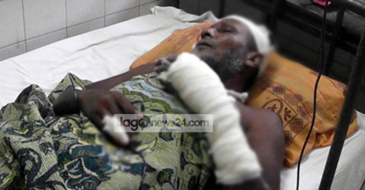 ফুলগাজীতে কৃষকলীগ নেতাকে কুপিয়ে জখম