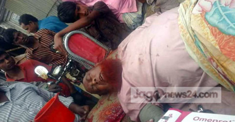 বৃদ্ধ বাবার দুই পা কেটে দিল দুই ছেলে