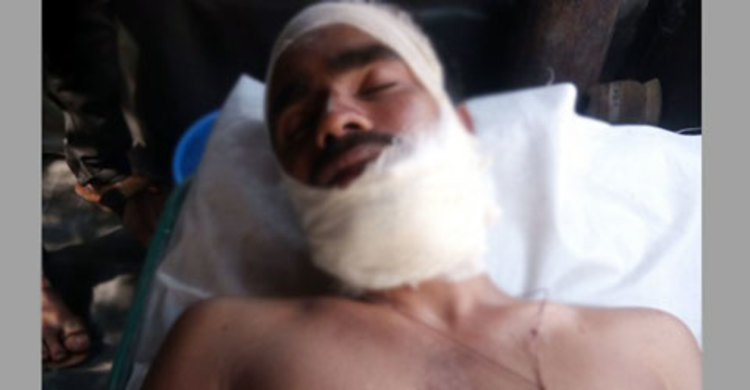 শালাকে কুপিয়ে জখম করলেন দুলাভাই