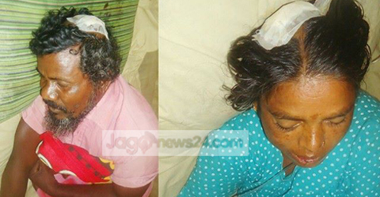 পানছড়িতে প্রতিপক্ষের হামলায় স্বামী-স্ত্রী আহত