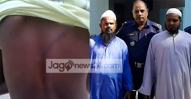 দুই ছাত্রকে ব্লেড দিয়ে কেটে দিল বড় হুজুর