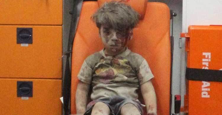 Photo of Syrian boy harmed in airstrike ‘manipulated’: Assad
