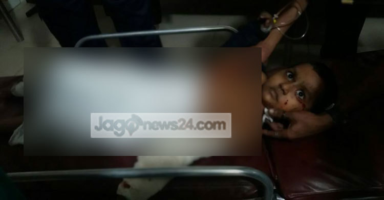 আহত শিশুটিও আশঙ্কামুক্ত নয়