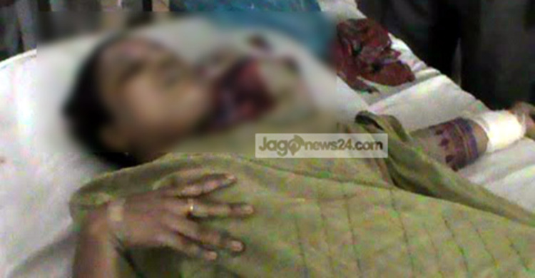 যৌতুকের দাবিতে শিক্ষিকাকে কুপিয়ে জখম 