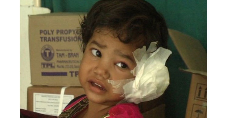 Girl has 80 worms removed from her ear