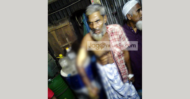 কিস্তির টাকা বাকি : শরীর ঝলসে দিল এনজিও কর্মী