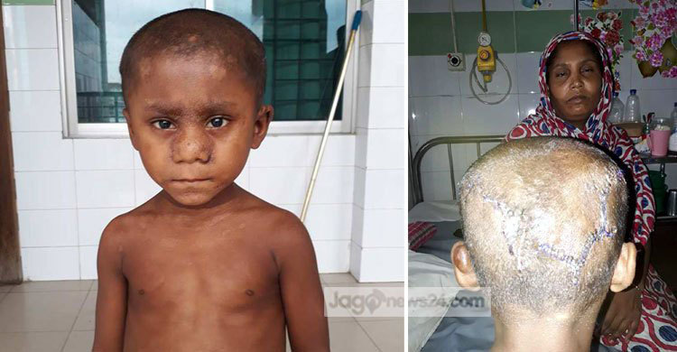 চিকিৎসা শেষে বাগেরহাটে ফিরছে আলিমুন