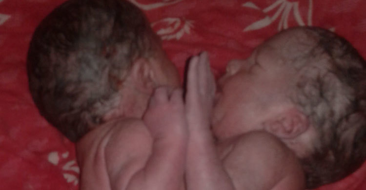 জমজ নবজাতক নিয়ে চিন্তিত একটি পরিবার