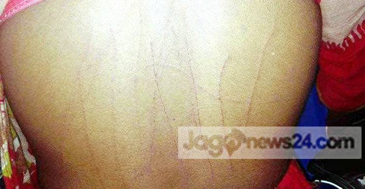 ব্লেড দিয়ে স্ত্রীর শরীর চিরে মরিচের গুঁড়া দিলেন স্বামী