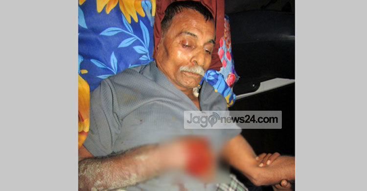মুক্তিযোদ্ধাকে পিটিয়ে হাত-পা ভাঙলেন আ. লীগ নেতা