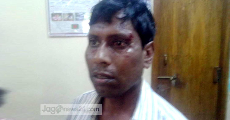 সিরাজগঞ্জে সাংবাদিকের ওপর হামলার ঘটনায় মামলা