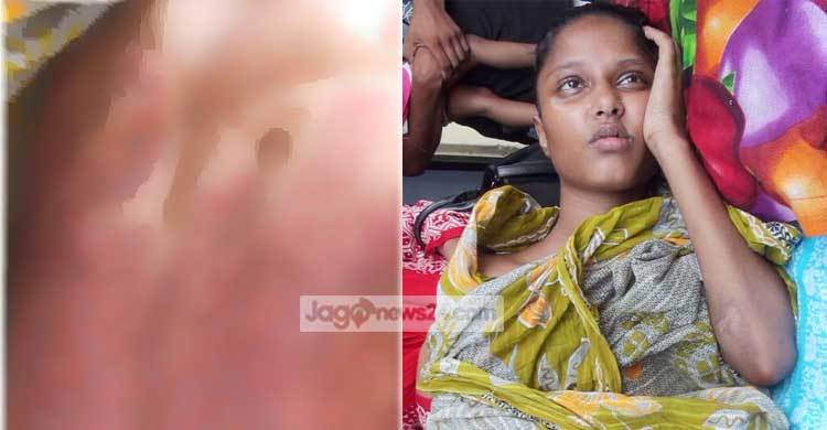 দেহ ব্যবসায় রাজি না হওয়ায় পাষণ্ড স্বামীর কাণ্ড!