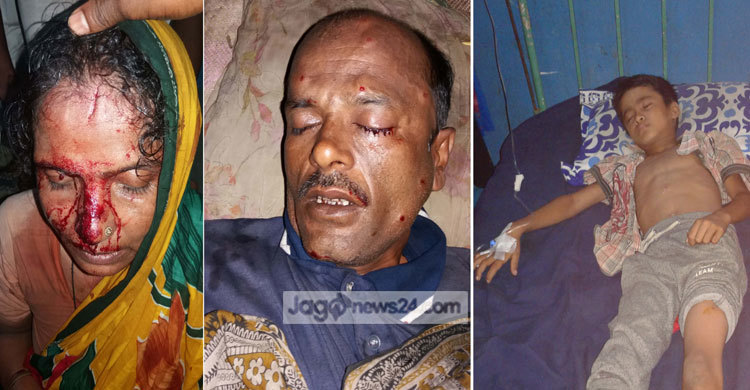 পেকুয়ায় স্টেশনে ভাঙচুর, গুলিবিদ্ধসহ আহত ১১