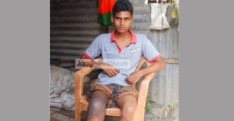 ৮ লাখ টাকা হলেই বাঁচবে সুজন