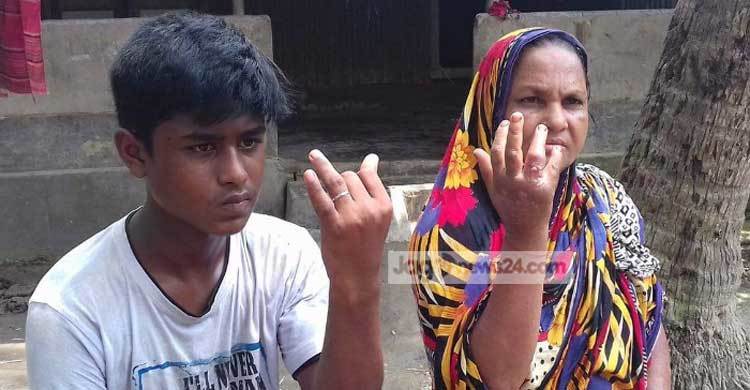 সিরাজগঞ্জে দুই দিনে ২১ জন অ্যানথ্রাক্স রোগী শনাক্ত