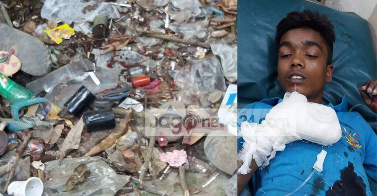 কুমিল্লায় কুড়িয়ে পাওয়া ককটেল বিস্ফোরণে কিশোর আহত
