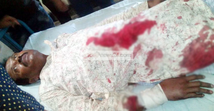 সড়ক দুর্ঘটনায় বিএনপি নেতা হাবিবসহ আহত ৫