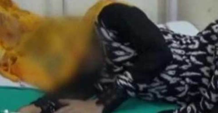 হাত কামড়ে ধর্ষণের হাত থেকে বেঁচে গেল স্কুলছাত্রী