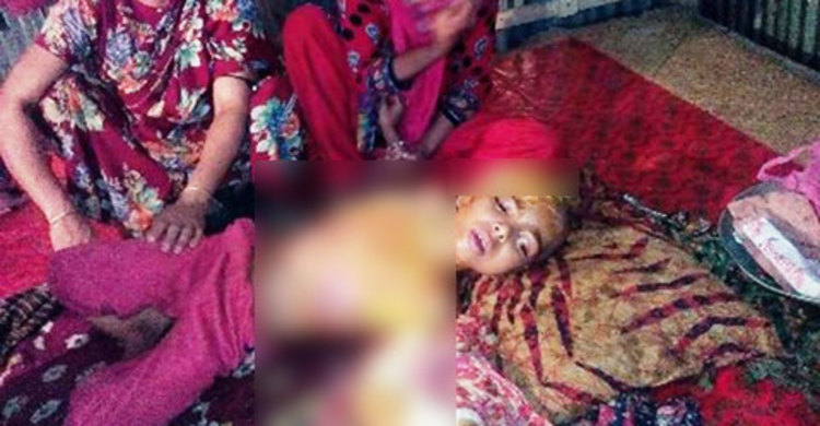 দগ্ধ সন্তান‌কে বাঁচা‌তে মা‌য়ের অাহাজা‌রি