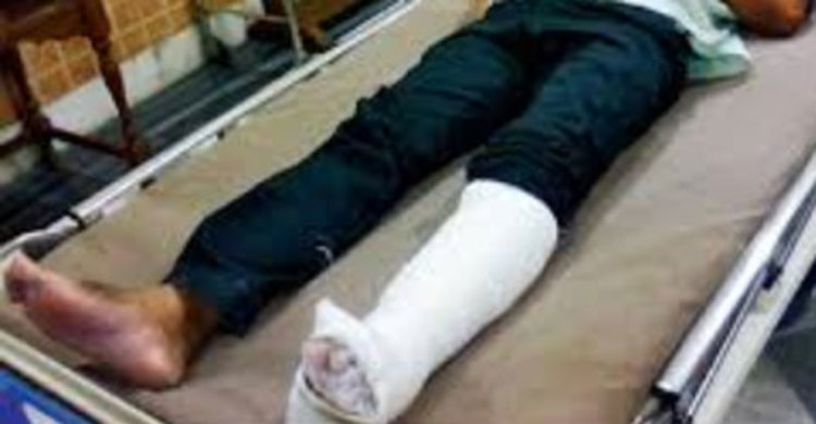 শ্রমিকের হাত-পা ভাঙলেন আ.লীগ নেতা