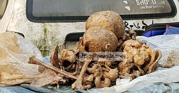 টঙ্গীতে ২ কঙ্কালসহ যুবক আটক