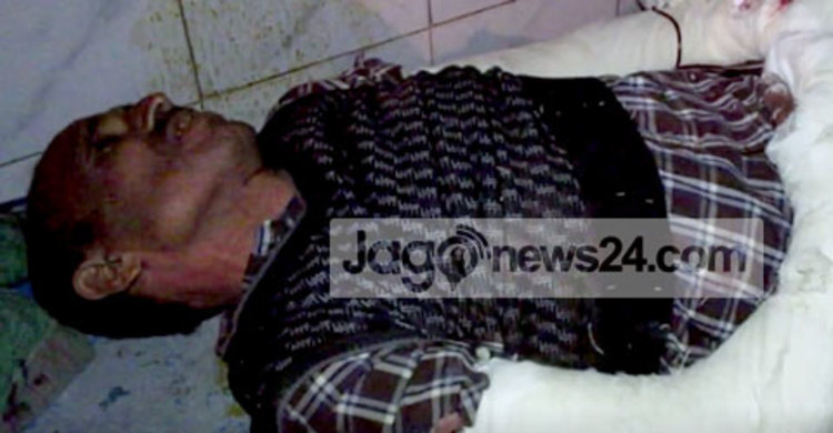 ঝিনাইদহে ইউপি সদস্যকে কুপিয়ে জখম