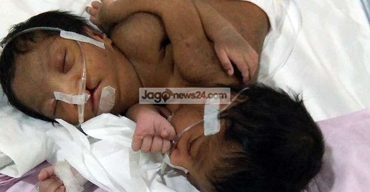 ইতি-সিথির হৃদপিণ্ড, ফুসফুস ও পাকস্থলি একটিই