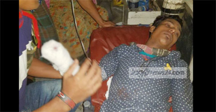 চাঁদা না পেয়ে ব্যবসায়ীর হাত কেটে আলাদা