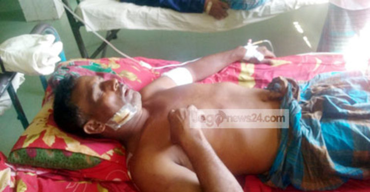 শরীয়তপুরে প্রতিপক্ষের হামলায় ইমামসহ আহত ৫