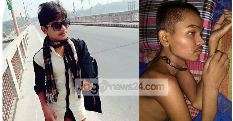 চিকিৎসার অভাবে মাংস খসে পড়ছে ক্ষুদে ফুটবলার বুলেটের