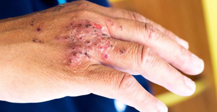 7 deadly diseases you can avoid by washing your hands
