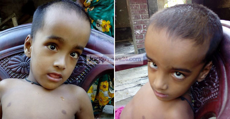 অভাবের কারণে ছেলের চিকিৎসার হাল ছেড়ে দিয়েছেন বাবা