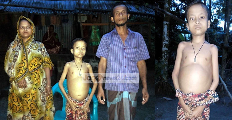 দিন দিন হাত-পা শুকিয়ে যাচ্ছে সাগরের