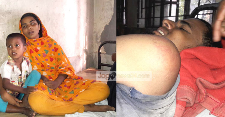 যৌতুকের জন্য ভাই-বোনকে পিটিয়ে জখম