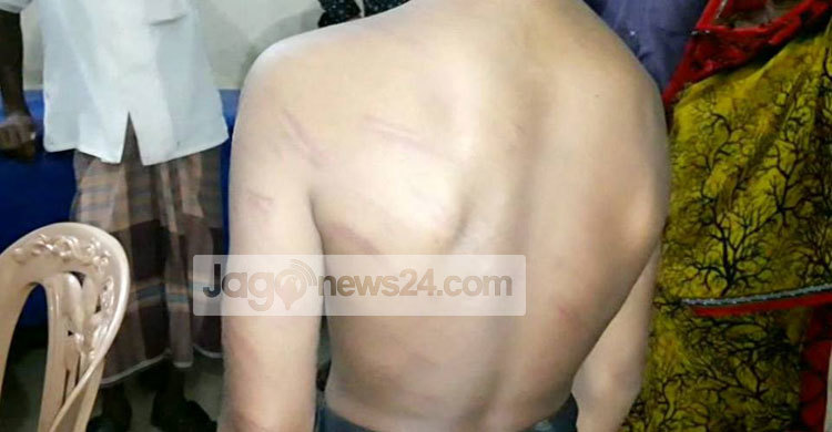 মোবাইল চুরির অভিযোগে শিশুকে পেটালেন এতিমখানার সুপার