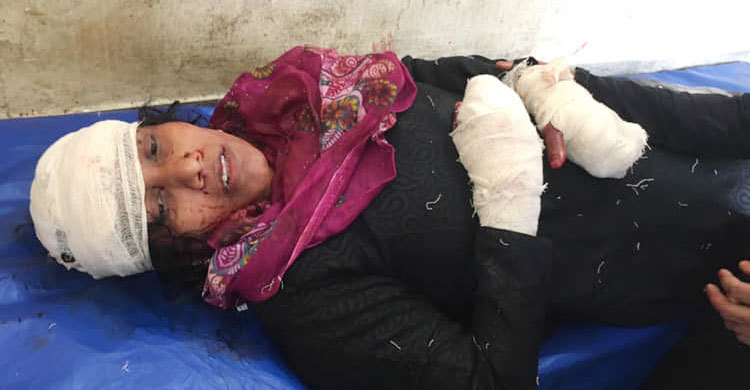 রাস্তায় প্রকাশ্যে স্ত্রীকে কোপালেন স্বামী